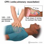 CPR