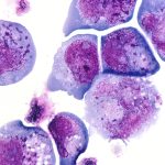 I Cell